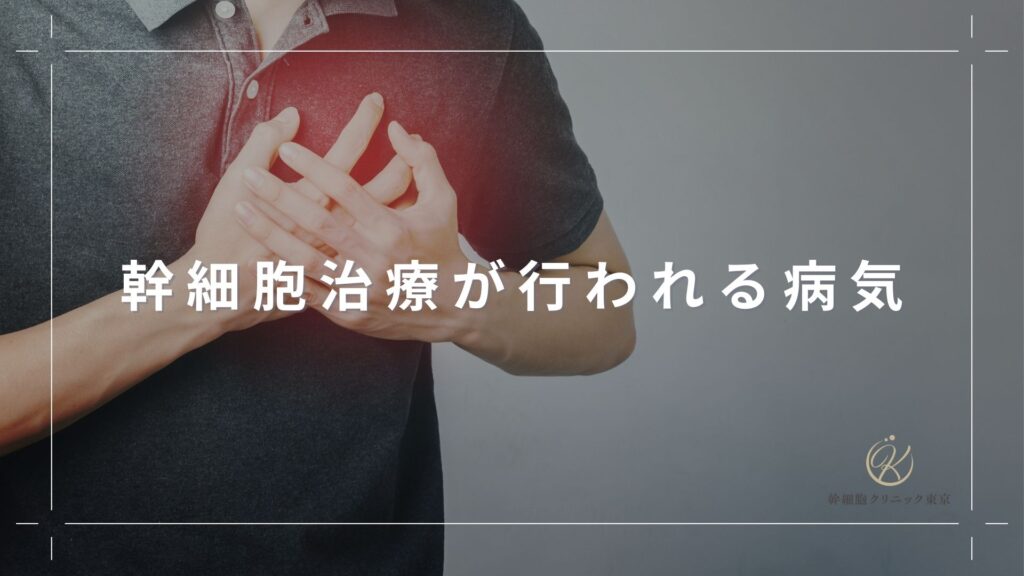 幹細胞治療が行われる病気